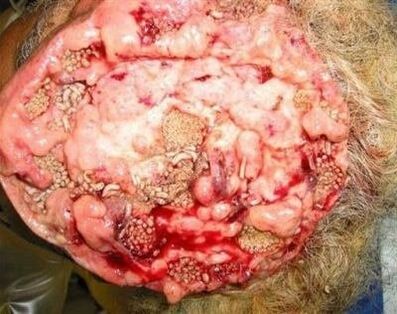 pasożyty w ludzkim mózgu